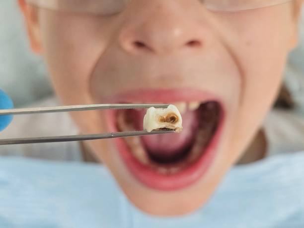 Best Pediatric Emergency Dentist in Lebanon, TN
